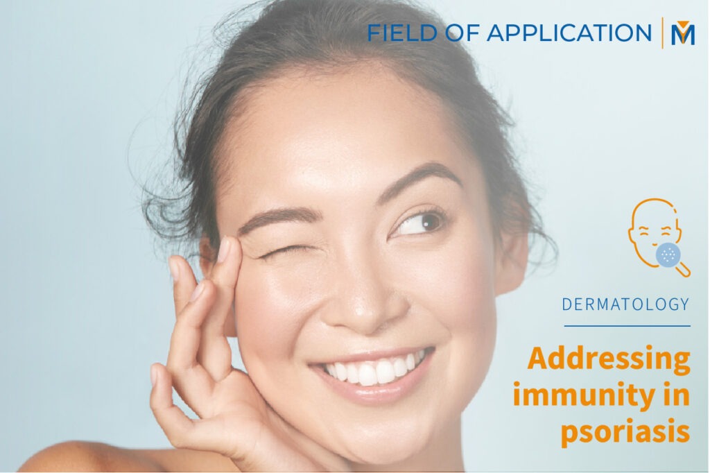 Post about address immunity in psoriasis